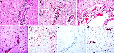 The First Case of Bovine Astrovirus-Associated Encephalitis in the Southern Hemisphere (Uruguay), Uncovers Evidence of Viral Introduction to the Americas From Europe